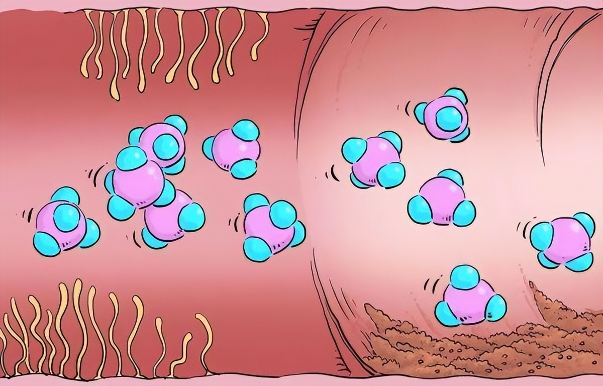 频繁放屁是咋回事真的是在排毒吗,频繁的放屁是有什么妇科问题吗