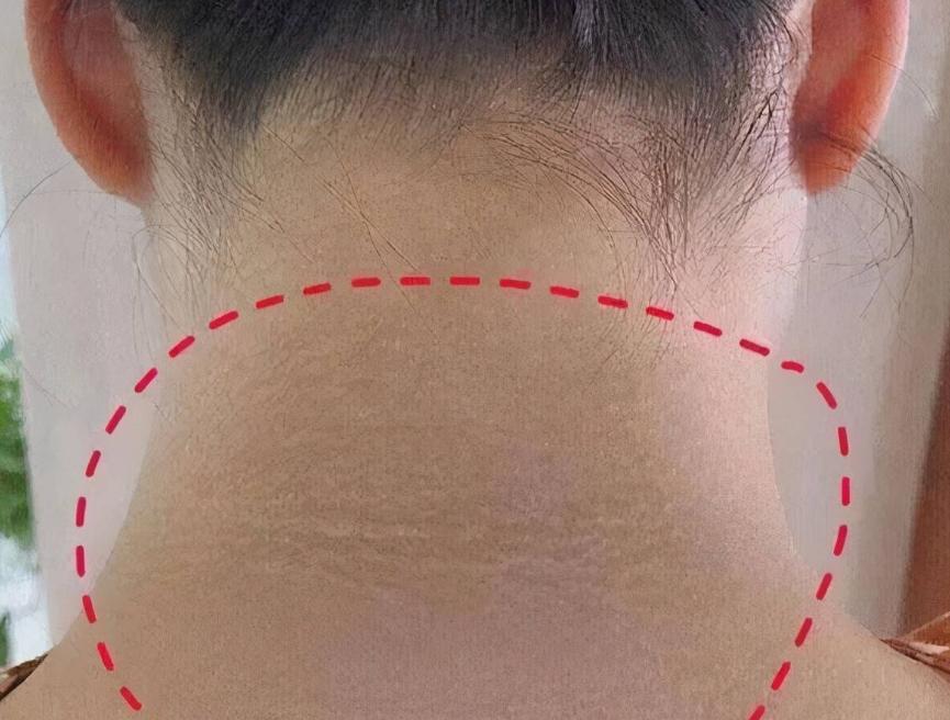 *处私**黑，是因为“经历”太多？医生：别乱猜，或与这4种病有关！