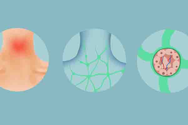 晚上睡觉绒的床单老是出汗,床单上出汗怎么回事