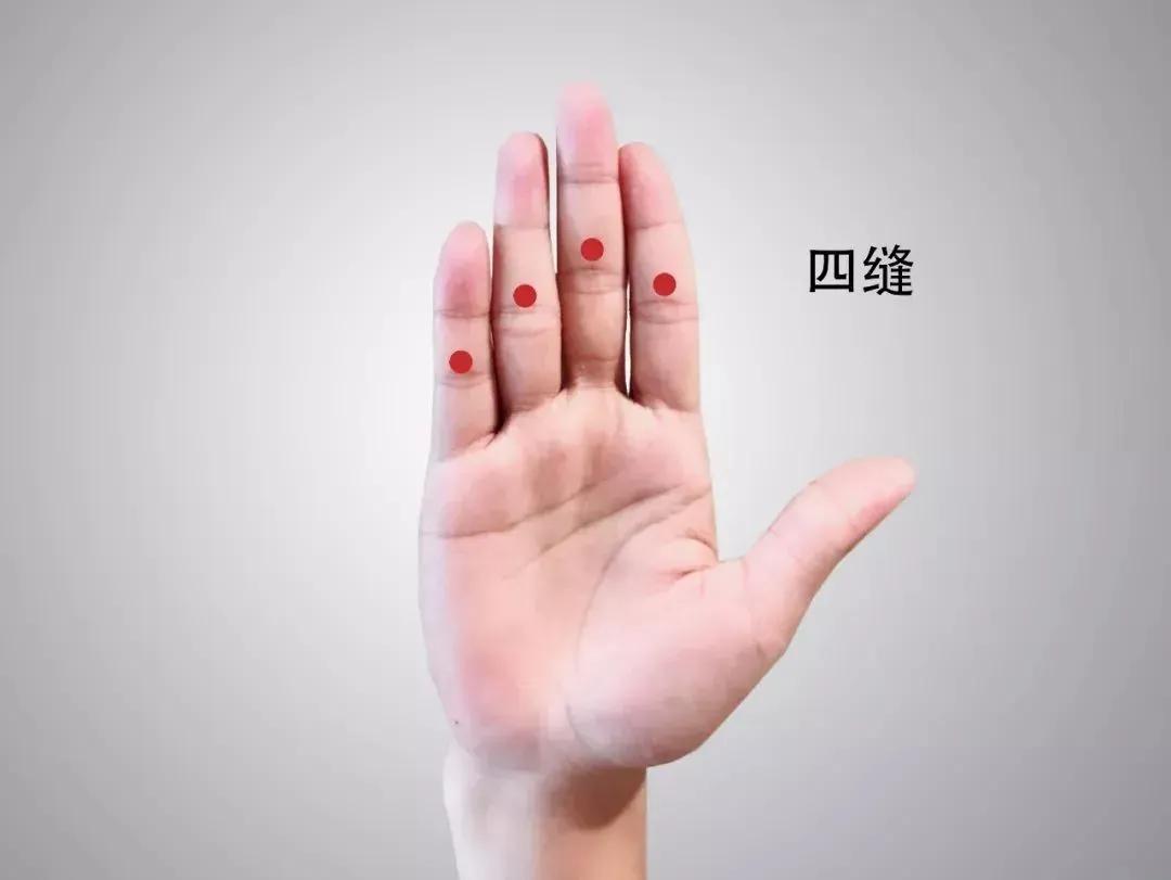 小儿是如何挑疳积的,挑疳积的原理是什么