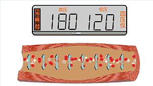 图解血管堵塞全过程，三氧疗法保持血管“年轻态”！