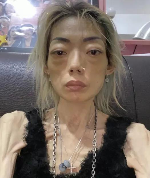 曾暴瘦到36公斤的女人,瘦了20斤就改变了她的一生
