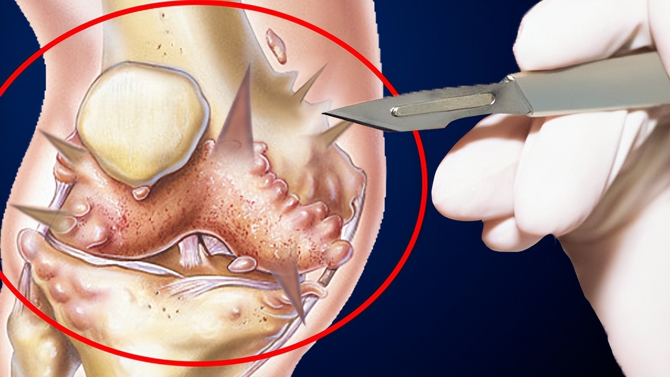 老年人膝盖疼响的最好治疗方法,老人膝盖软该注意些什么