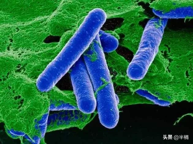 腐肉没有营养为什么有的动物吃,动物为什么能吃腐肉