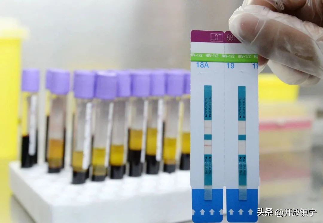 我们与艾滋认识了多久,我们与文明的距离