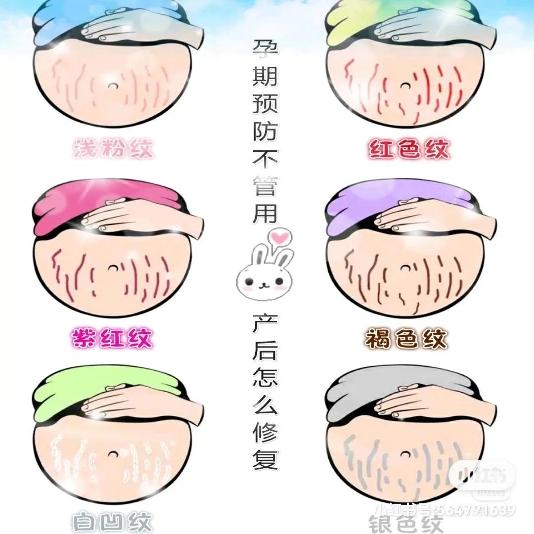 马油可以预防妊娠纹吗,孕早期预防长妊娠纹的妊娠油推荐