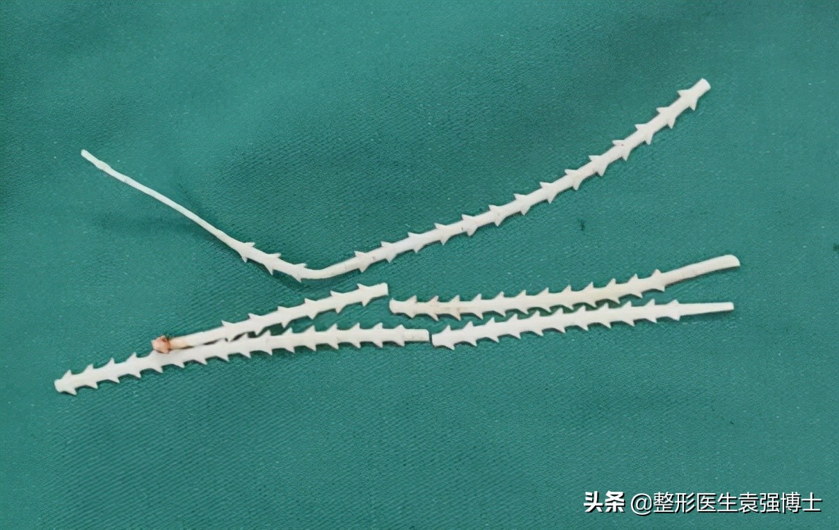 脸下垂松弛提升最好的办法,55岁脸部松弛下垂做什么锻炼紧致