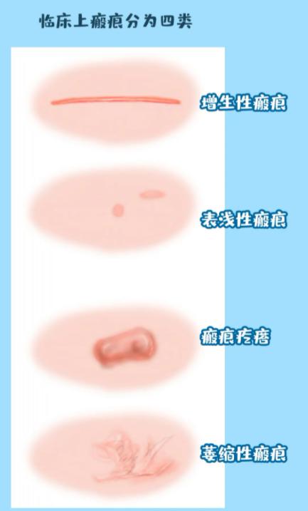 太原95后征兵体检,山西征兵下半年体检什么时候开始