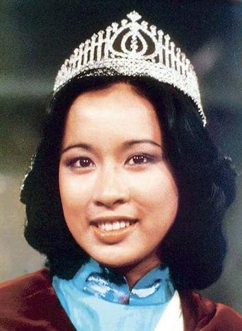 烤瓷牙的明星,烤瓷牙的明星都有谁