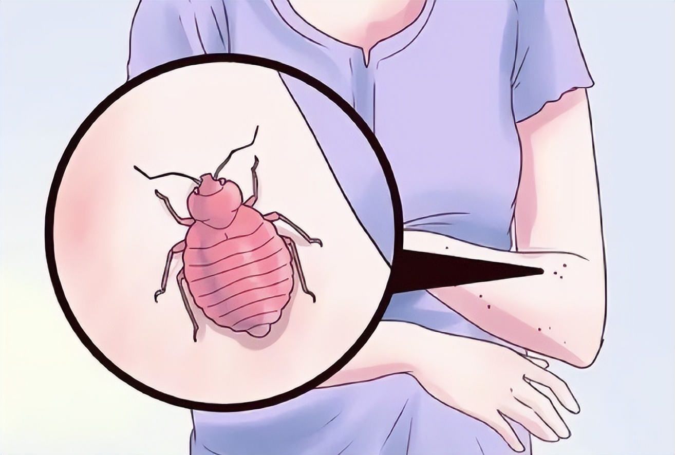 房间有床虱买什么杀虫剂,被床虱跳蚤臭虫咬了是什么症状