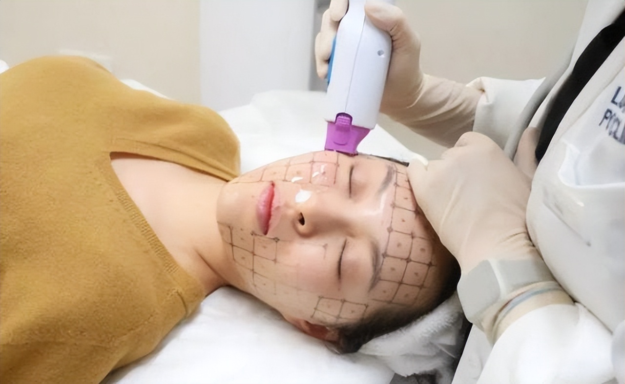 热玛吉是越年轻效果越好吗,热玛吉适合哪种肌肤