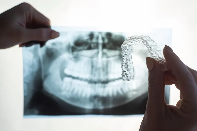 牙齿治疗天价,牙齿矫正两万利润多少