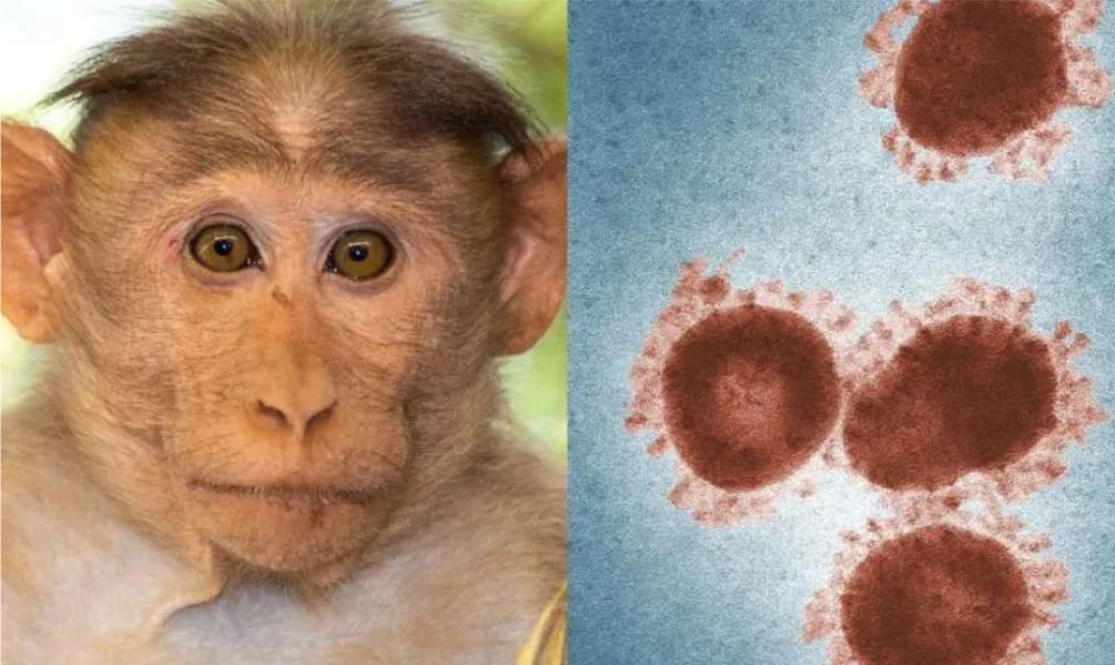 突发，沈阳发现一猴痘病例！