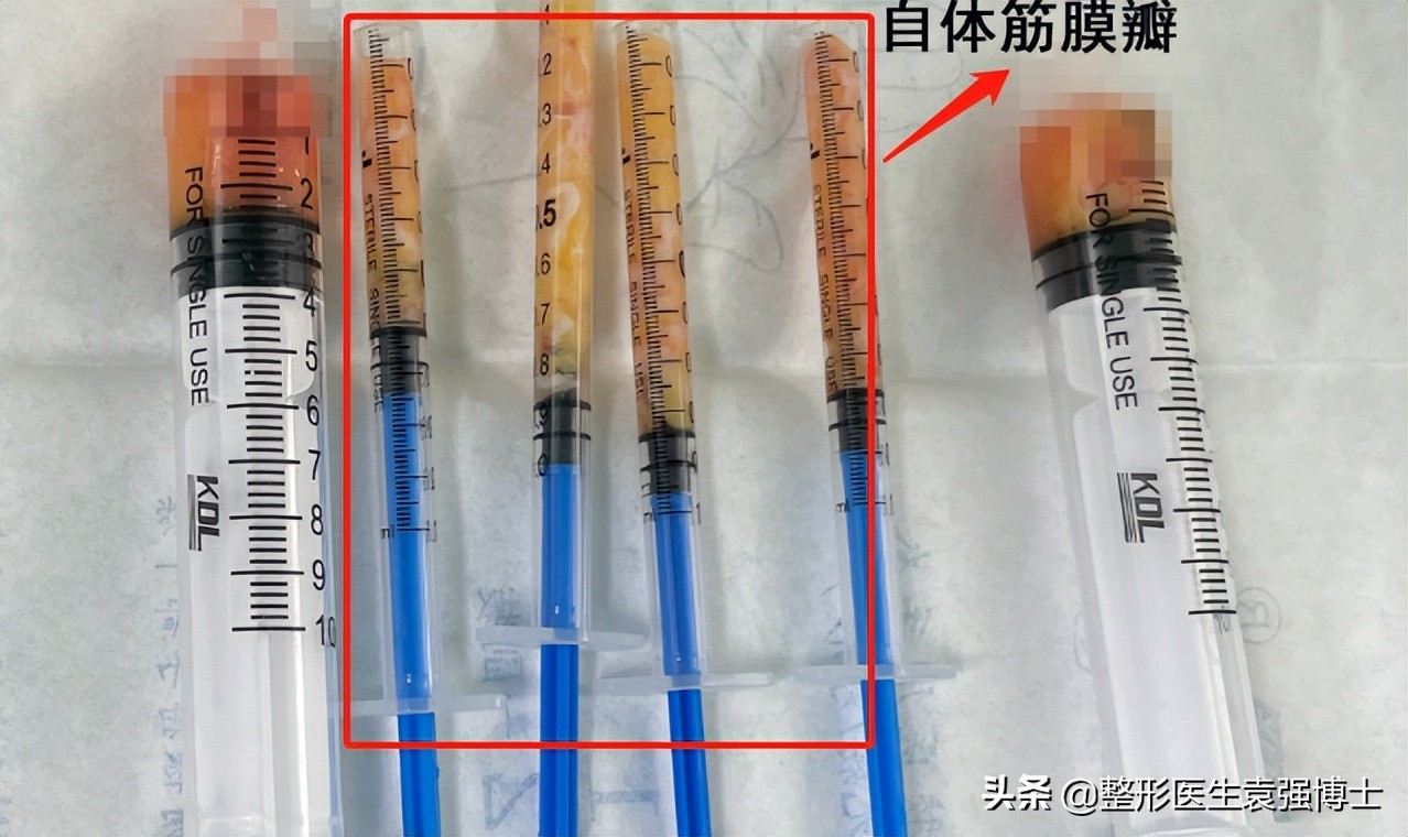 40岁女人脸要怎么保养去法令纹,40岁男士法令纹最新消除法