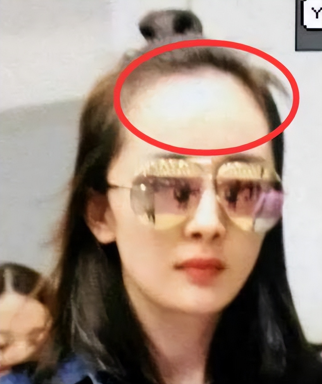 女明星也秃头？杨紫鞠婧祎全靠小心机，杨幂没刘海就是“光明顶”