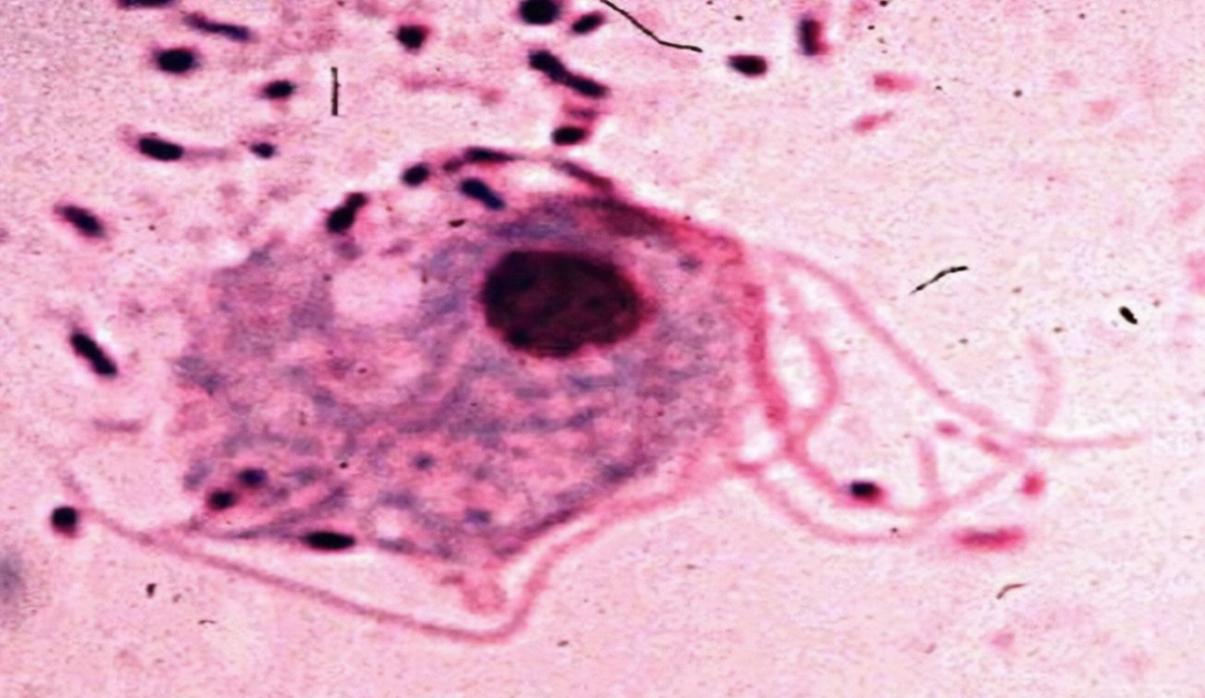 阴道护理科普,阴道常规保养