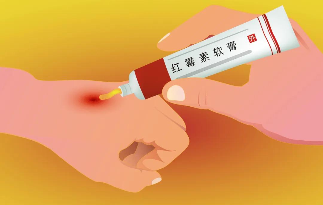 红霉素软膏可以涂眼部吗,红霉素软膏涂眼睛的副作用