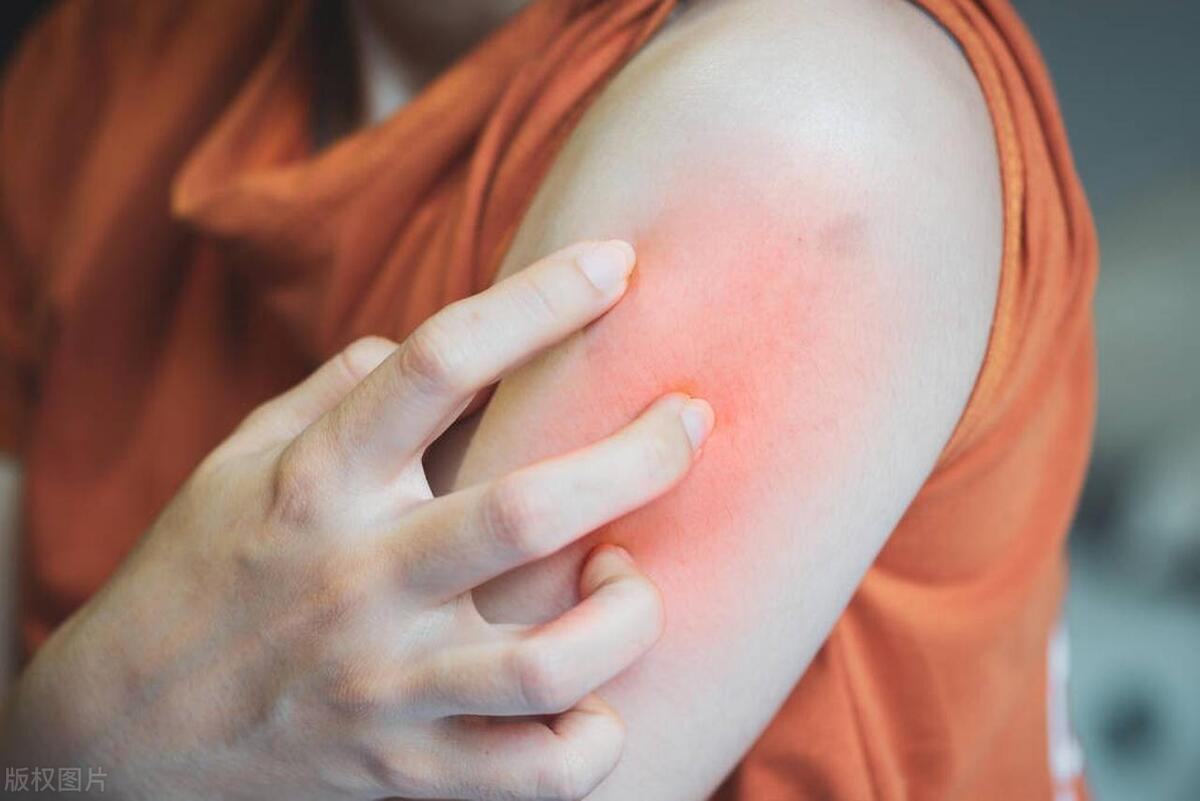 18岁刚参加完高考感染艾滋病,18岁女孩染上艾滋