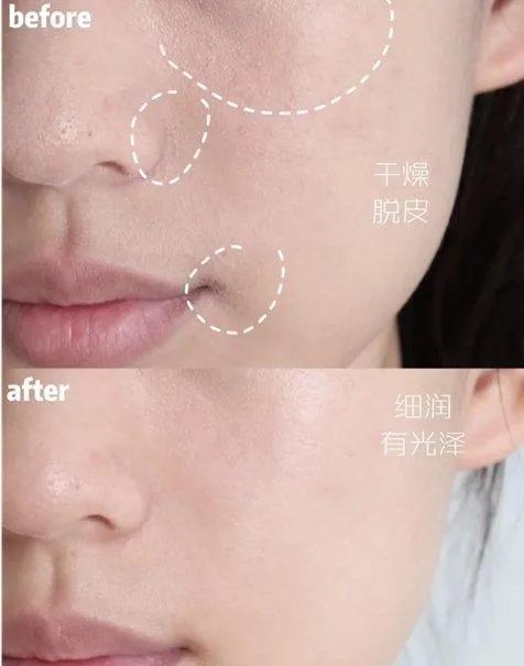 ahc神仙套装水乳成分测评,ahc神仙水乳套装先用哪个