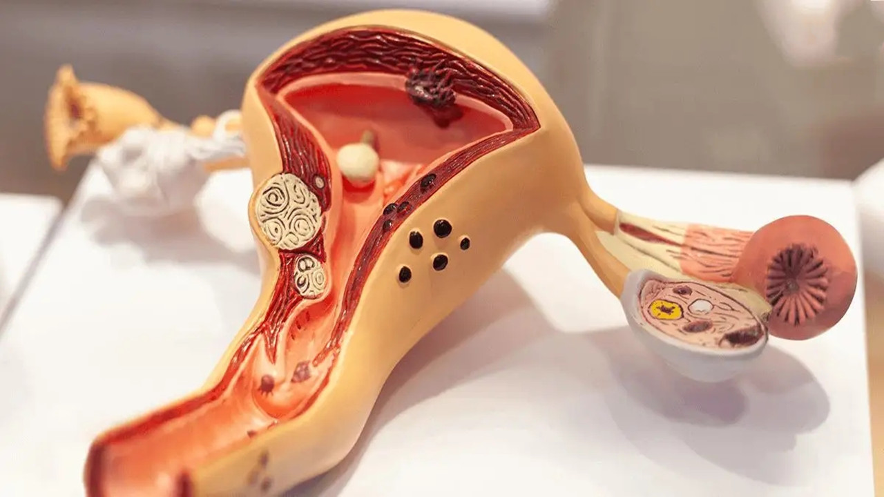 为什么月经完了还有红色分泌物,为什么月经完了会有褐色的白带