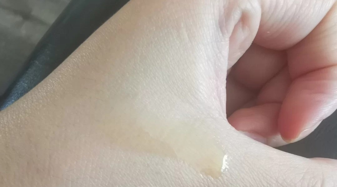 以油养肤哪些精华油最适合,以油养肤干皮精华油推荐测评