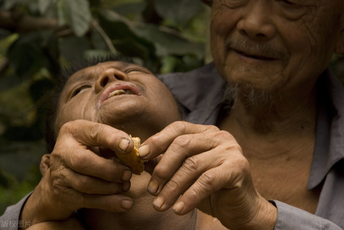 北京长峰医院神经内科专家胡颖科普:脑瘫治疗难点及预后情况分析