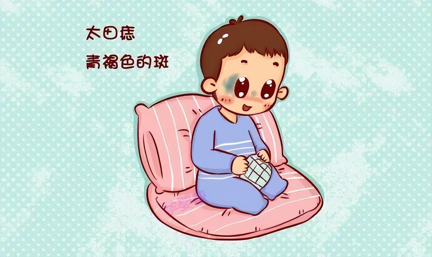 激光打青胎记一般需要几次,1厘米的黑色胎记做激光去除