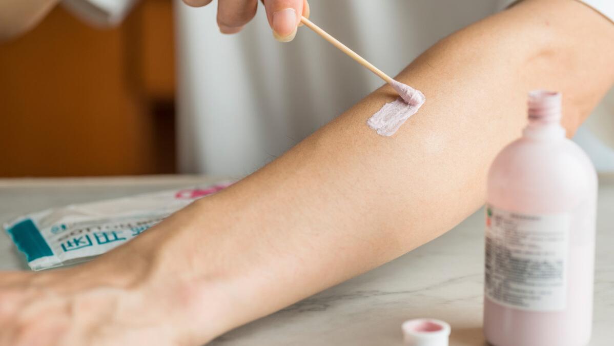 炉甘石洗剂正常皮肤能用吗,炉甘石洗剂治疗皮肤病很有效