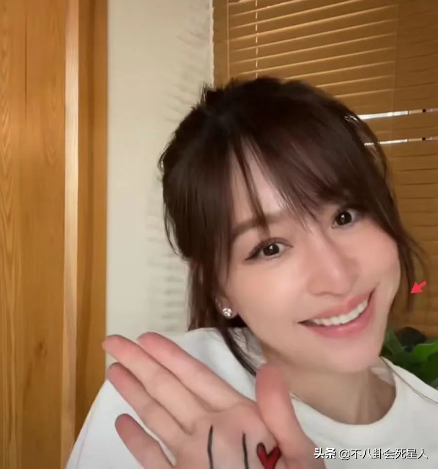 杨雪的脸怎么了,杨雪毁容了吗