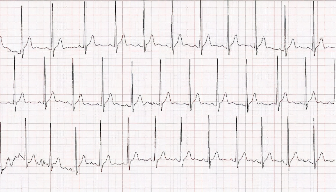 男子突然晕倒到医院检查心跳,男子喝酒腹痛急诊