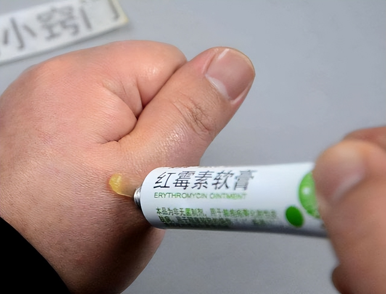 为啥老人斑会自行掉了,有人说红霉素软膏治老年斑