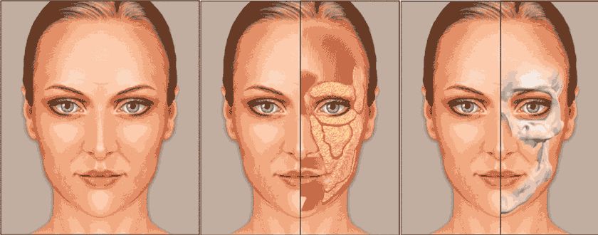 很深的法令纹有什么办法去除,日常如何去除法令纹