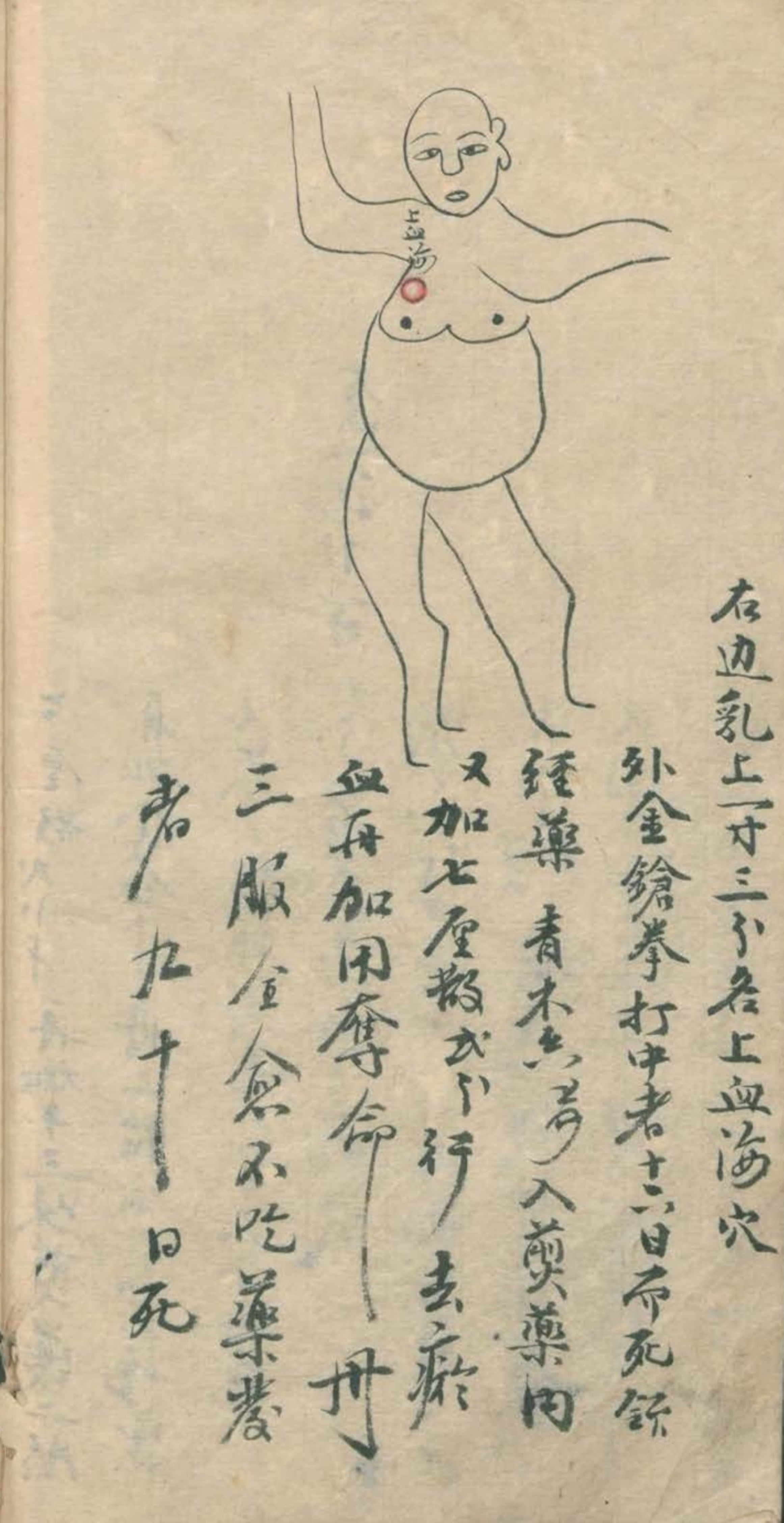 武当秘传跌打八法,民间中医古籍手抄本专医跌打秘方