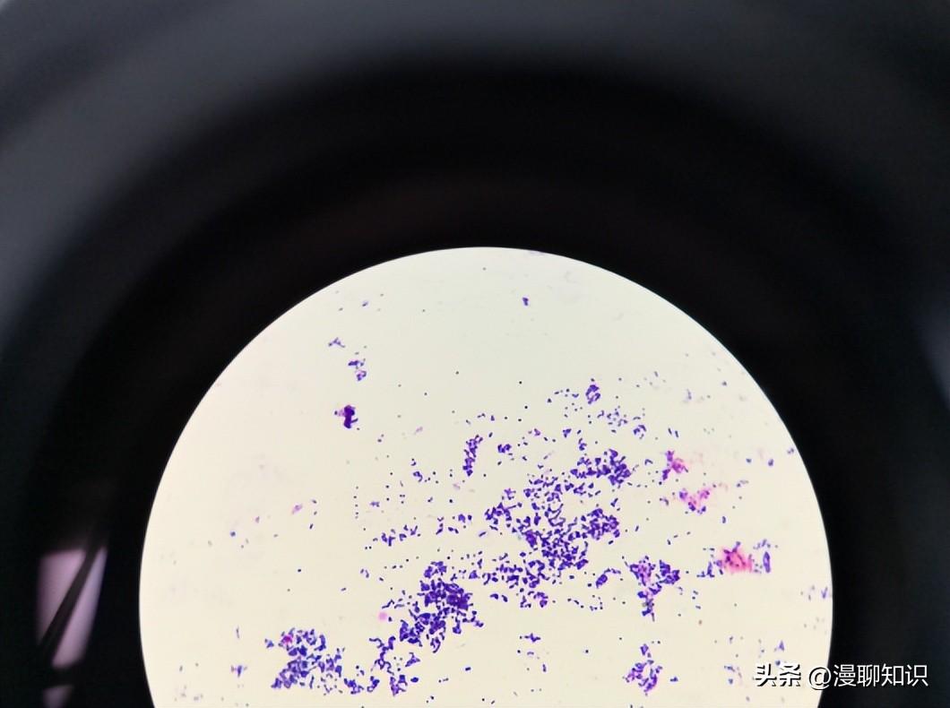 牦牛是高山地区牛的独特品种，肉质鲜嫩，但却饱受葡萄球菌的侵害