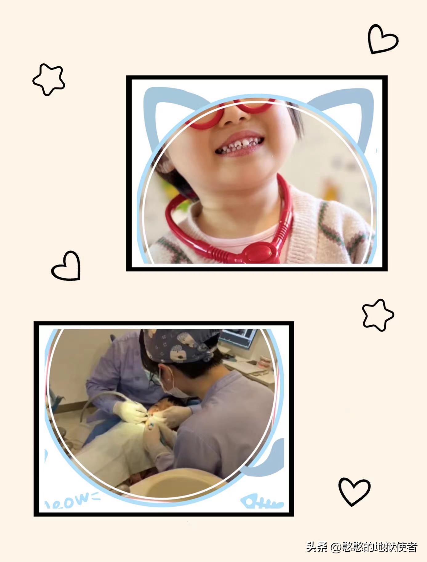 小孩几岁可补牙,两岁多的宝宝可以补牙吗