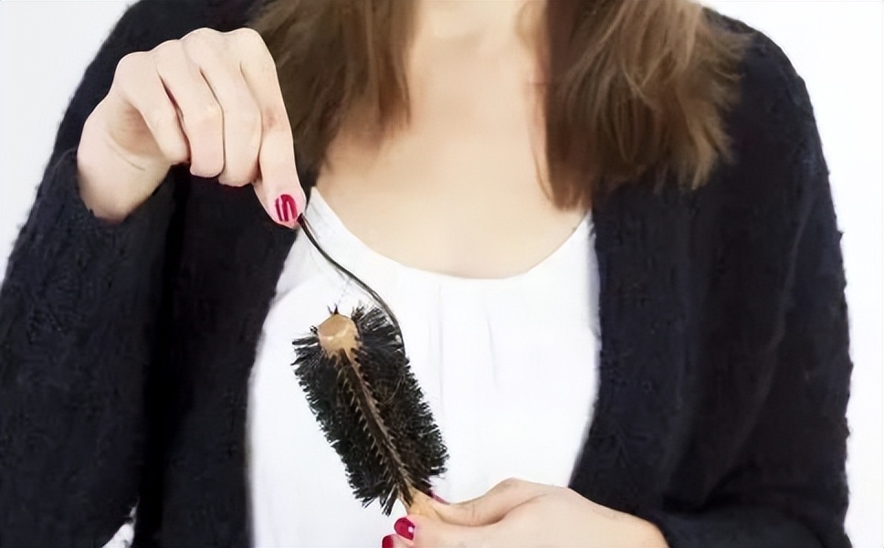 肾藏精，其华在发，中医助你“守住”发际线