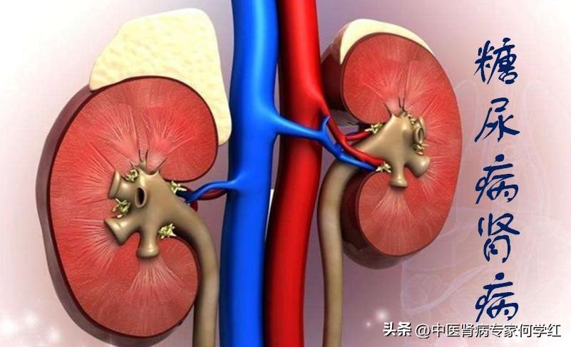 糖尿病肾病尿蛋白高的方剂,糖尿病肾病尿蛋白高吃什么药