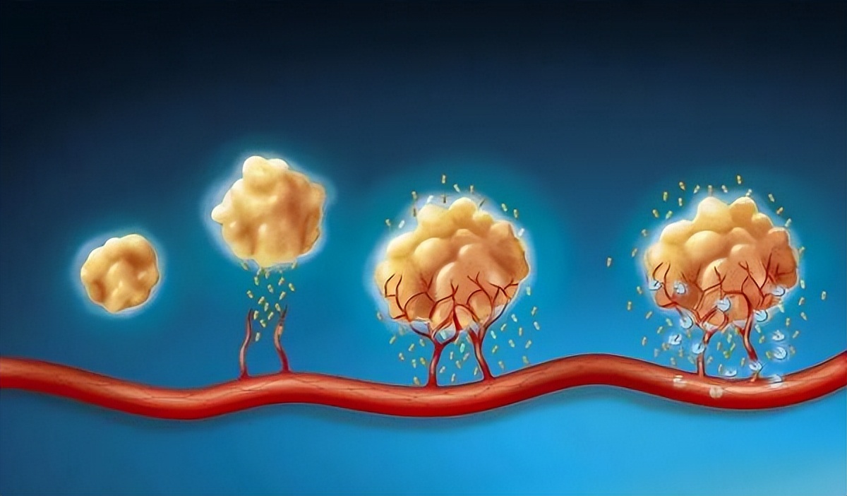 癌症患者临死前的8个征兆,癌症患者自述生病诱因