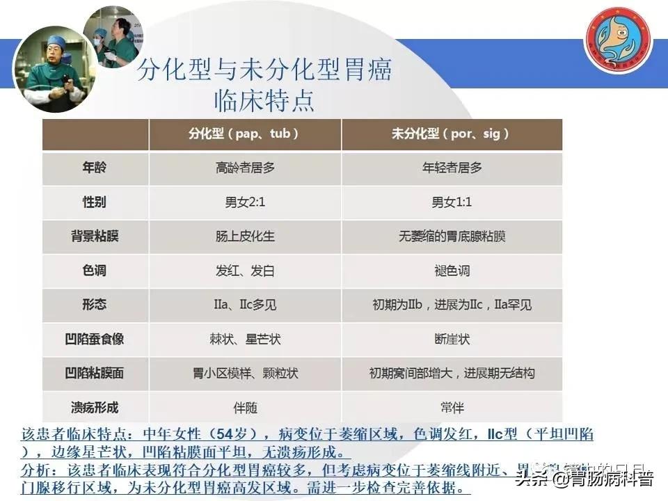 胃癌可以做内镜手术吗,早期胃癌内镜手术后追加外科手术