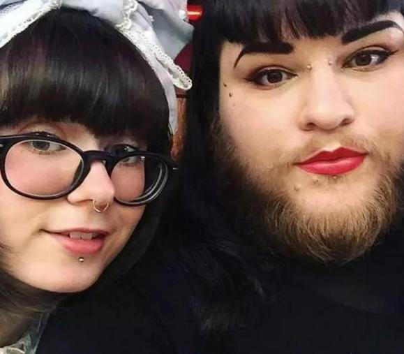 女性体毛生长旺盛与哪些原因有关,关于女性体毛过多的真实原因