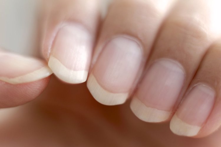 指甲黑竖纹与癌有关吗,指甲癌是什么症状