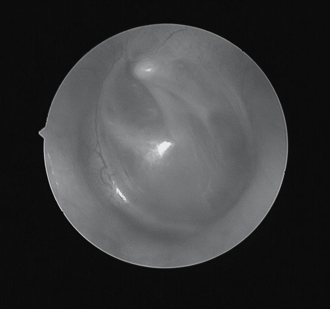 南昌二附院耳鼻喉科手术,南昌大学第二附属医院耳鼻咽喉科