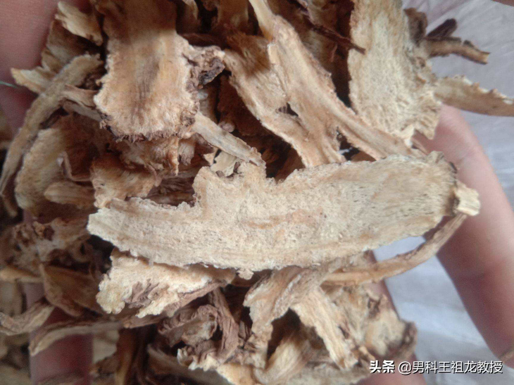 中医治疗静脉曲张的有效验方是,静脉曲张实用单方验方大全