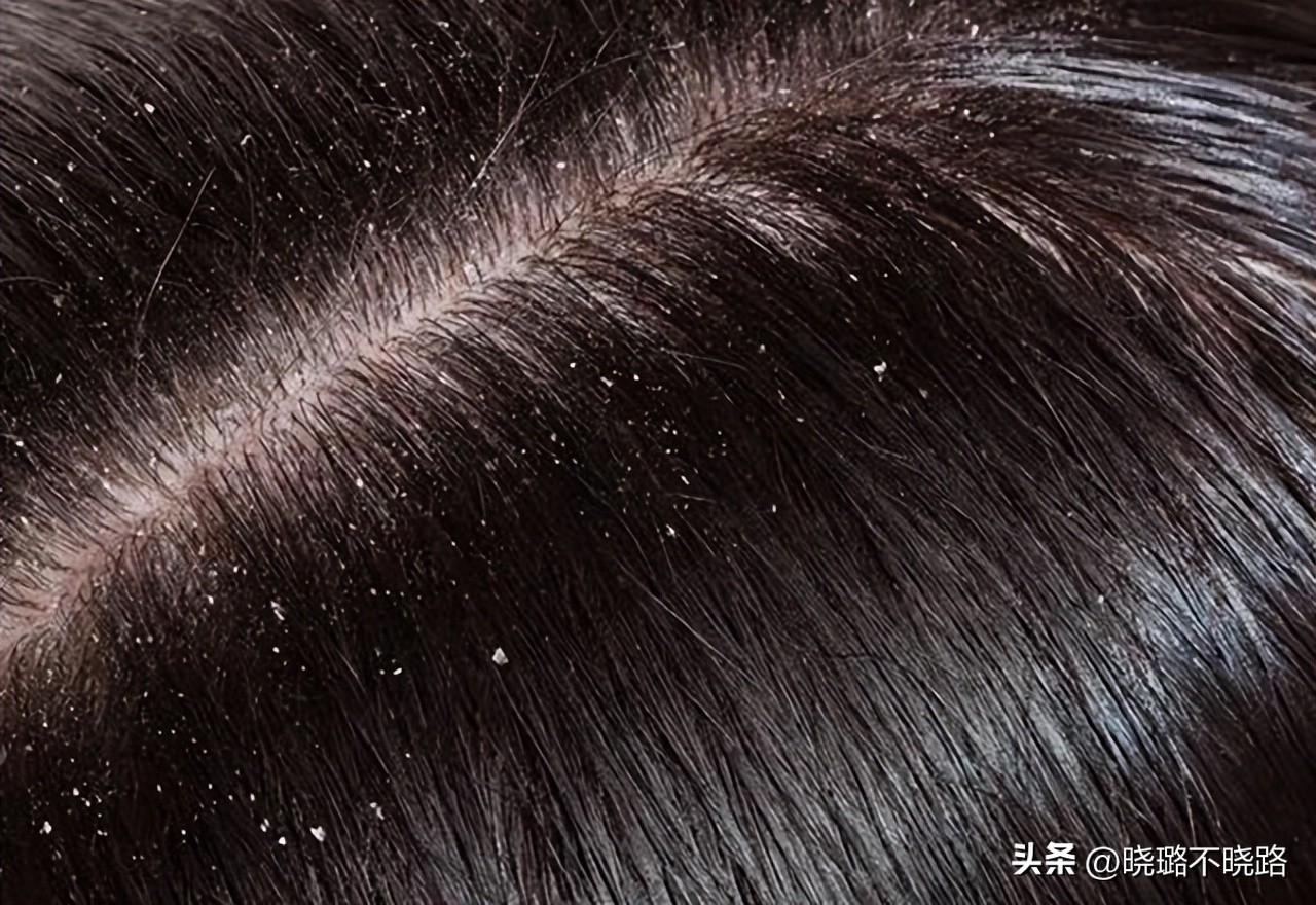 怎样才能知道你适合长发还是短发,看看你适合长发还是短发