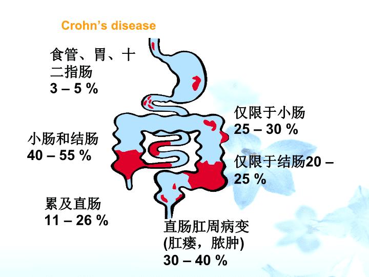 治疗克罗恩病最好药物及其副作用,克罗恩病中药和西药治疗哪种好