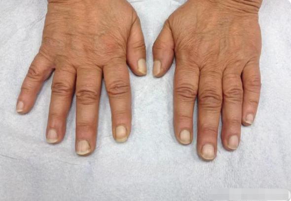 指甲上的月牙代表什么视频,指甲上月牙颜色代表什么