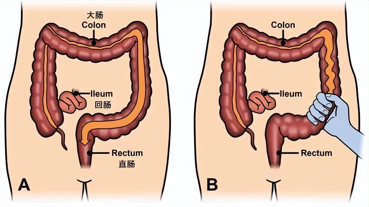 为什么总会想尿尿,关键时刻想喝水