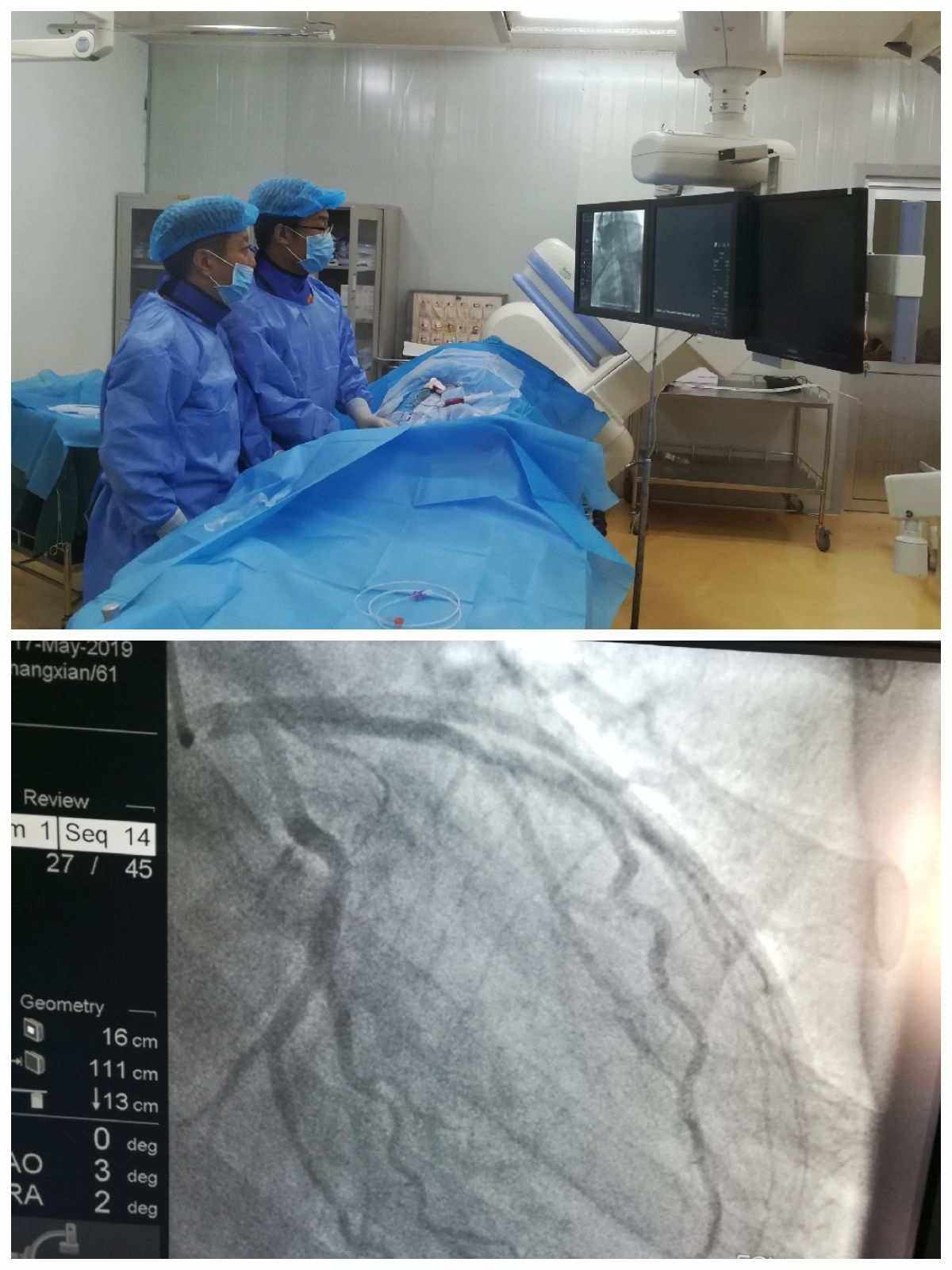 医生科普常见的5种心血管疾病,高死亡率的疾病