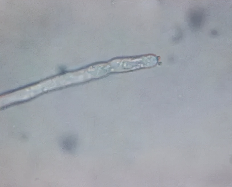水产养殖霉菌怎么处理,水产养殖杀水霉方法