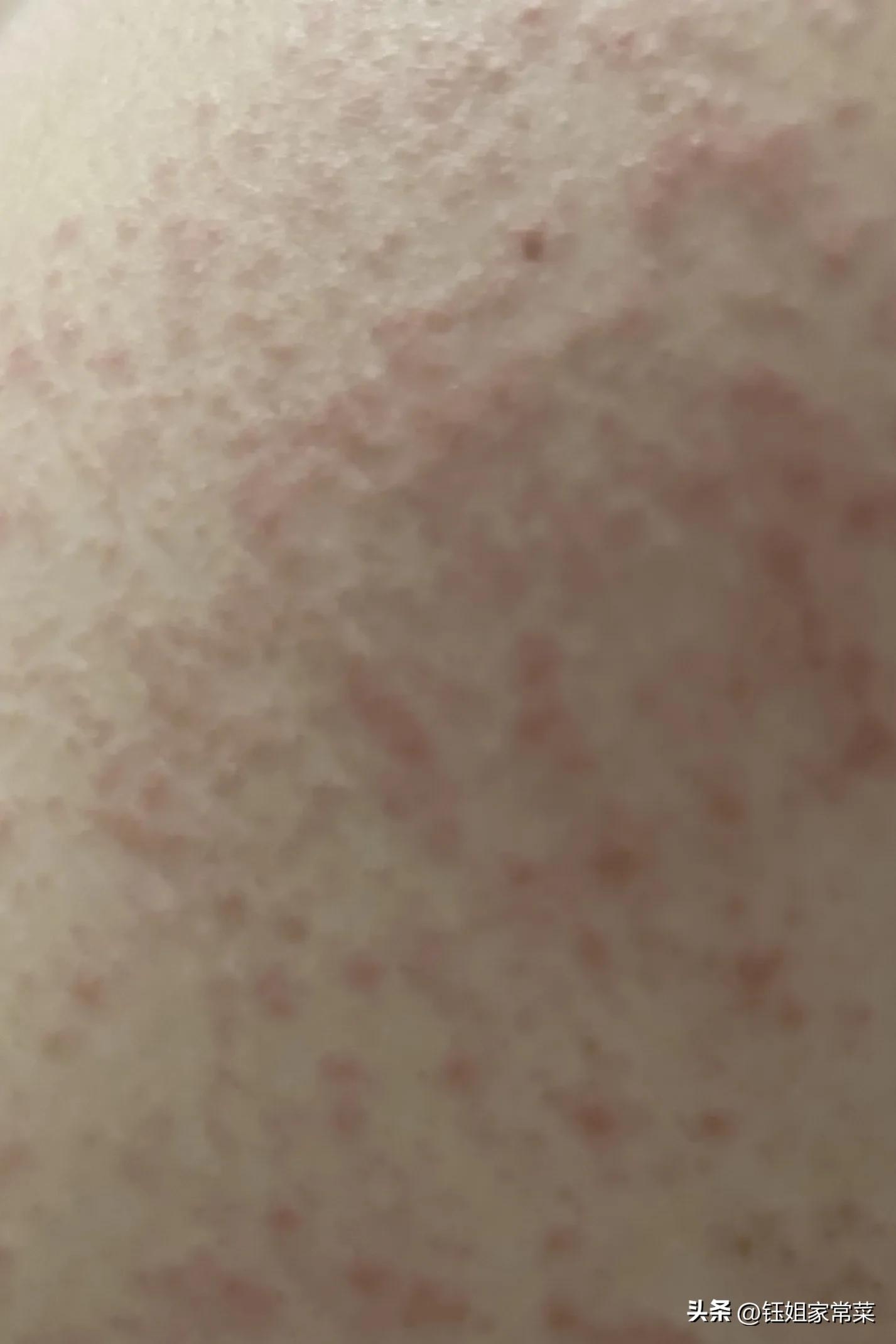 閽板婀栧崡,婀栧崡閽板